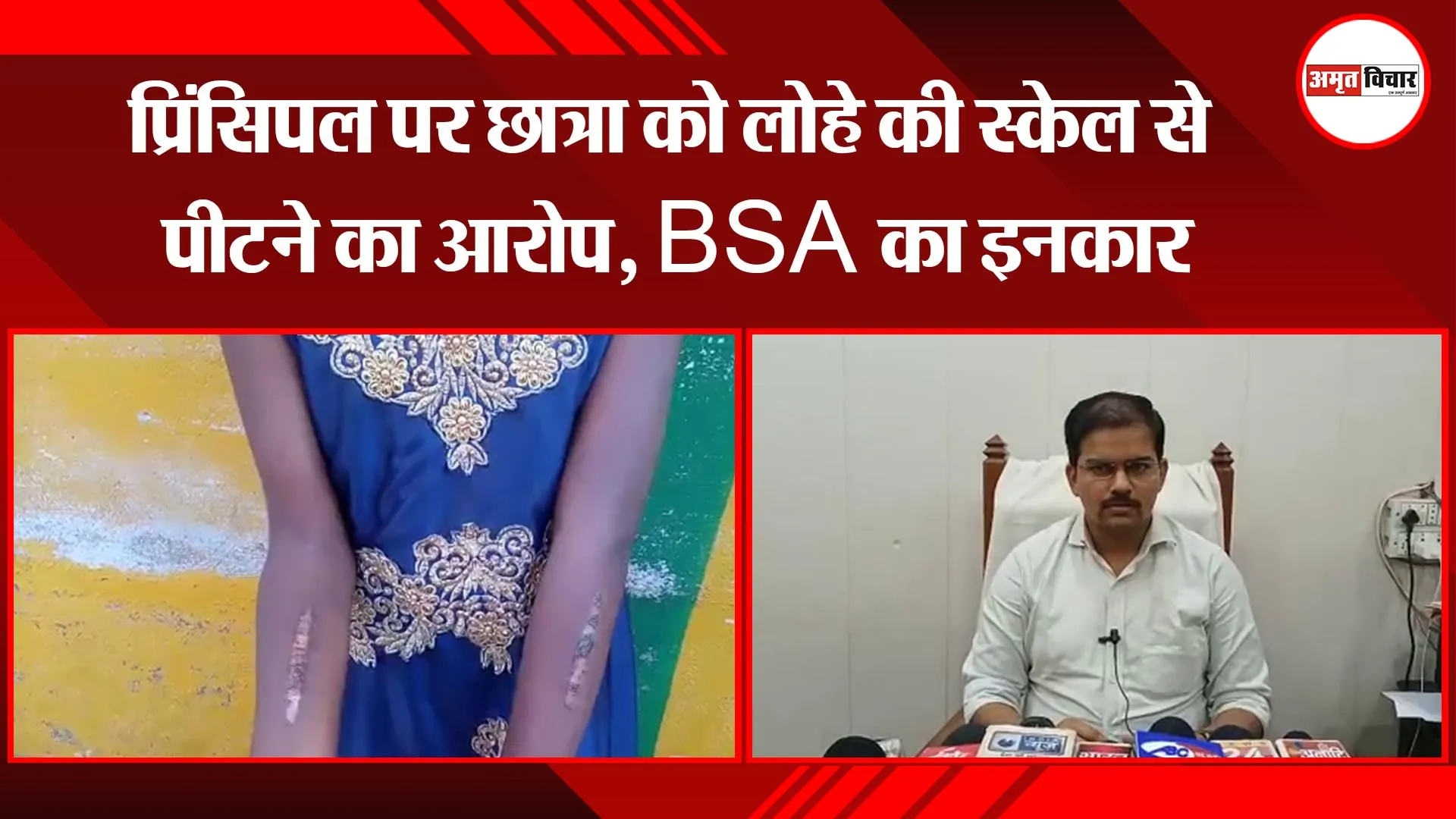 उन्नाव: प्रिंसिपल पर छात्रा को लोहे की स्केल से पीटने का आरोप, BSA का इनकार