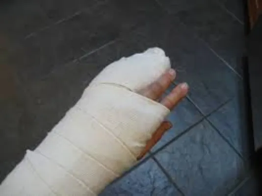 लखनऊ: दीवार गिरने से चार बच्चे घायल, एक की हालत गंभीर