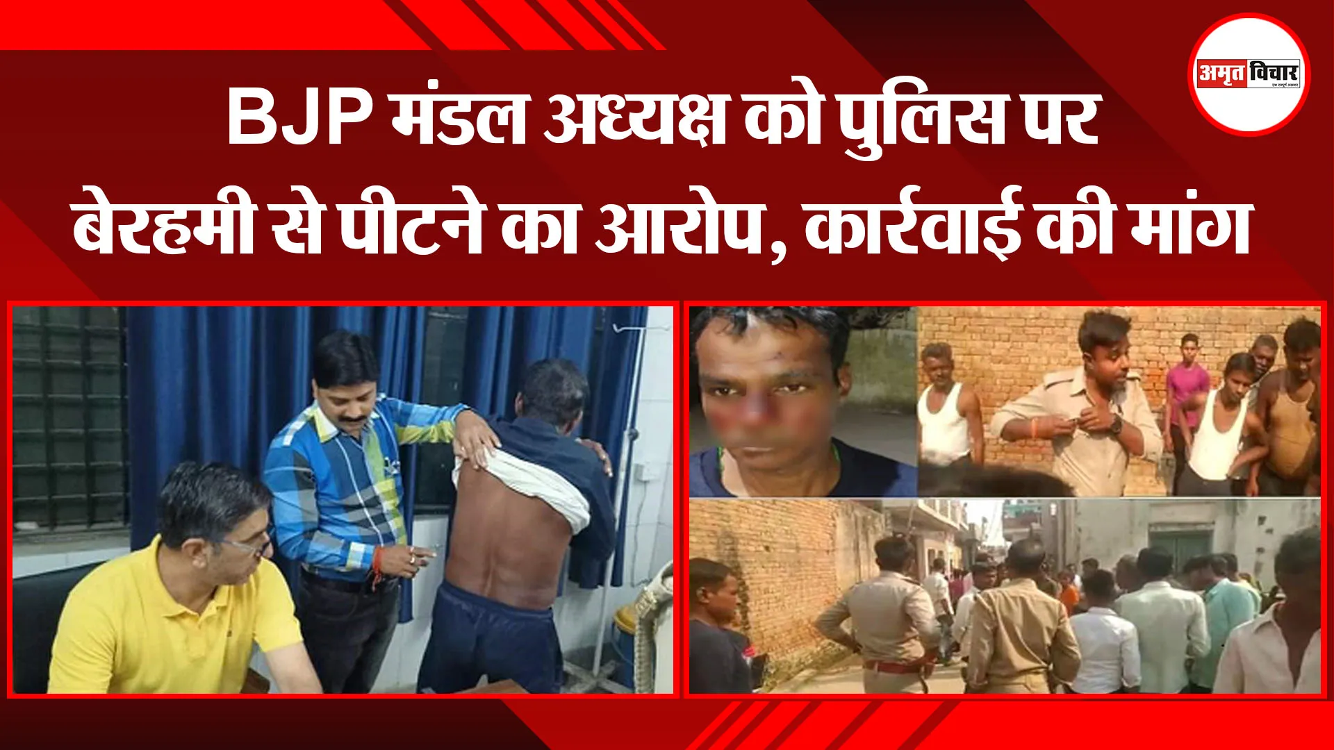संभल: BJP मंडल अध्यक्ष को पुलिस पर बेरहमी से पीटने का आरोप, कार्रवाई की मांग