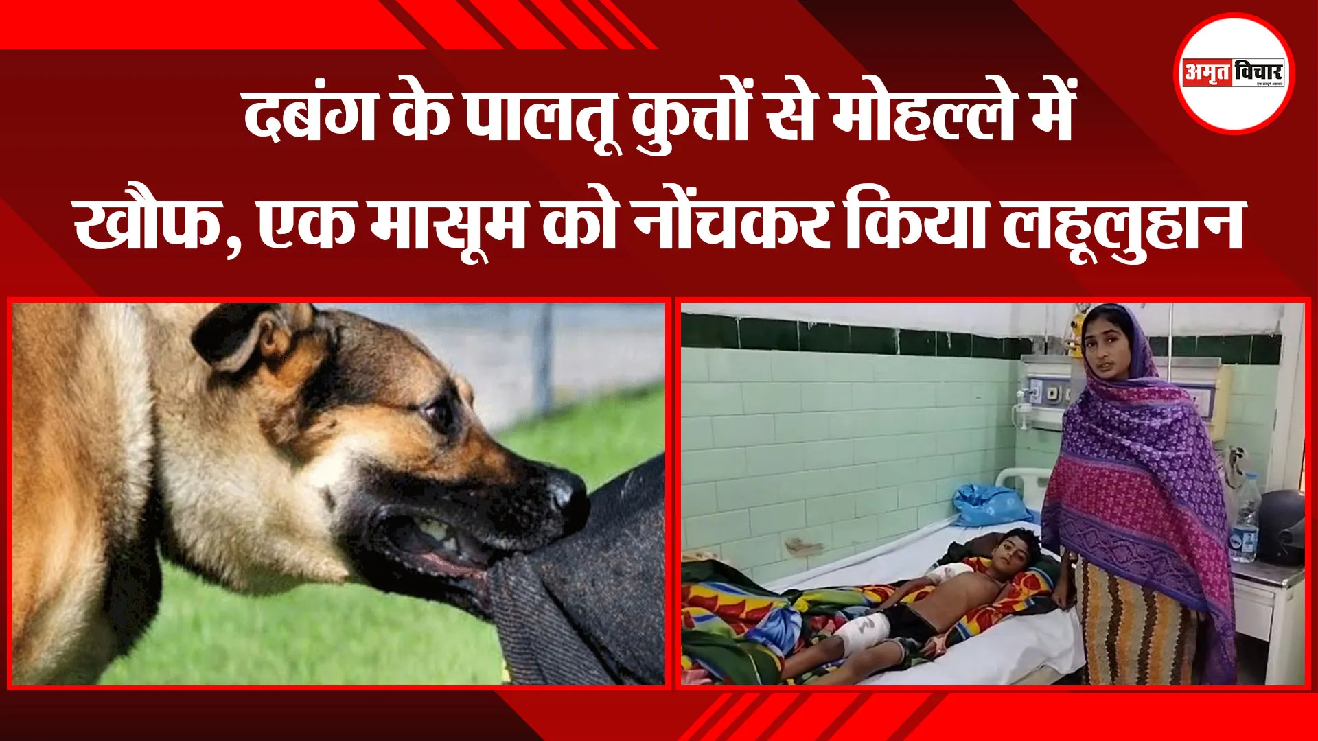 बरेली: दबंग के पालतू कुत्तों से मोहल्ले में खौफ, एक मासूम को नोंचकर किया लहूलुहान