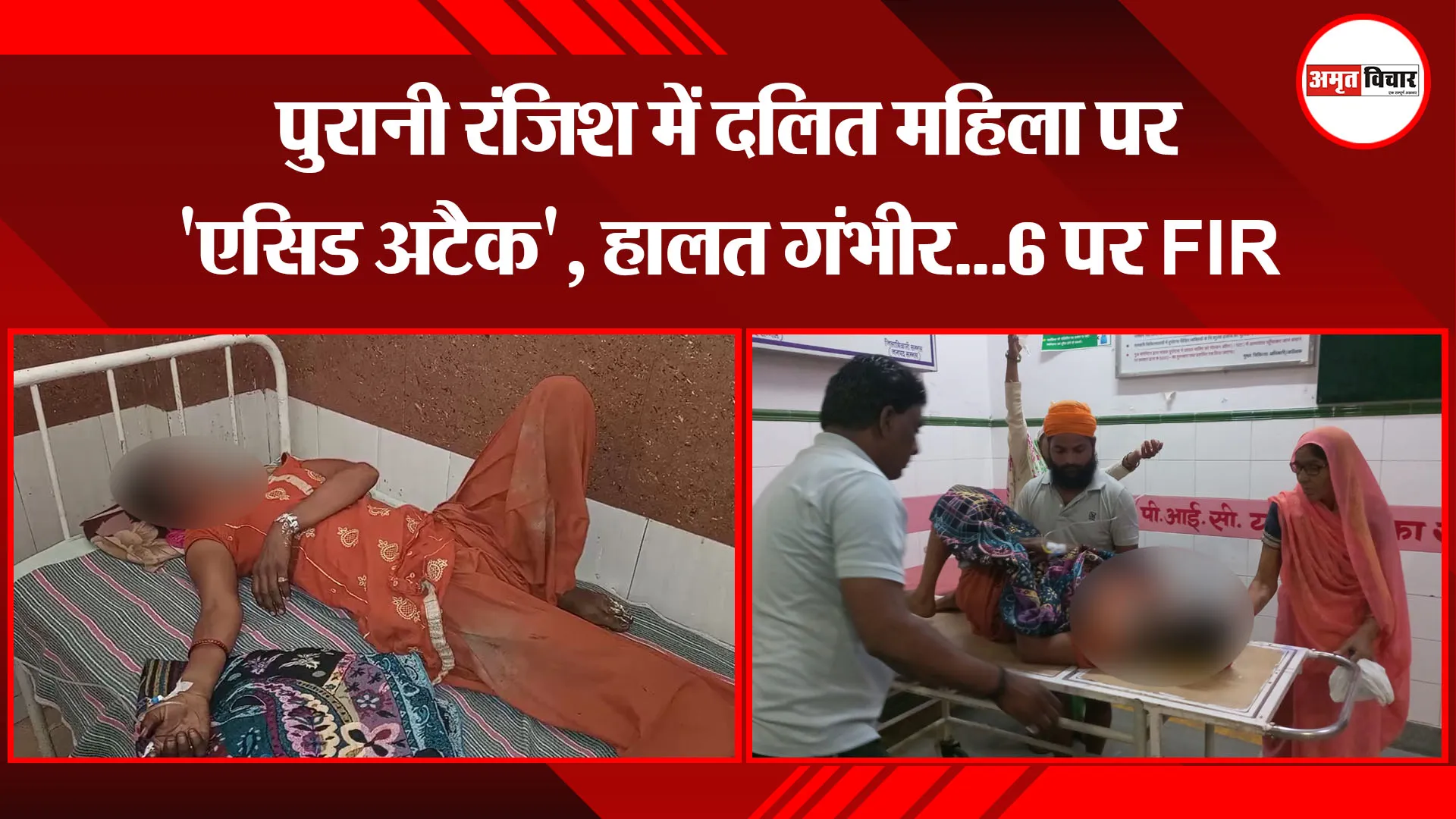 संभल/मुरादाबाद: पुरानी रंजिश में दलित महिला पर ‘एसिड अटैक’, हालत गंभीर…6 पर FIR