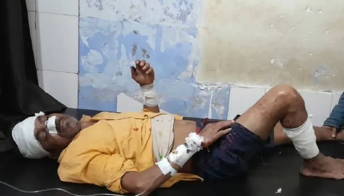 बहराइच: तेंदुए के हमले से ग्रामीण घायल, आत्मरक्षा के लिए 10 मिनट तक करता रहा संघर्ष
