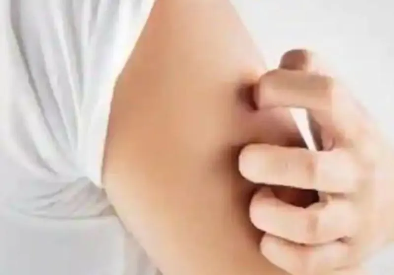 सर्दियों में शरीर पर होती है खुजली तो करें ये काम... मिलेगा आराम