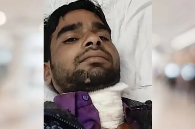 पीलीभीत जेल में चाकूबाजी, एक बंदी का गला रेता