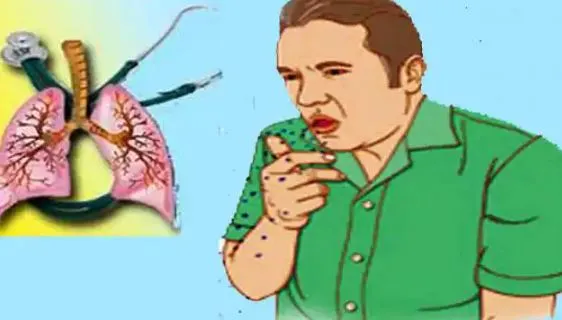 बरेली: टीबी का दंश मिटाने को शासन से आज आएगी टीम, करेगी सर्वे