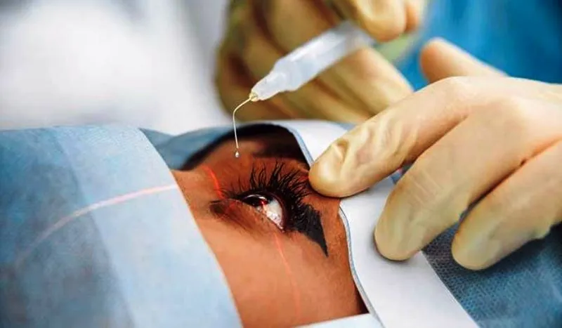 मोतियाबिंद के ऑपरेशन में छत्तीसगढ़ का यह जिला आया देश में अव्वल, केंद्र ने की तारीफ