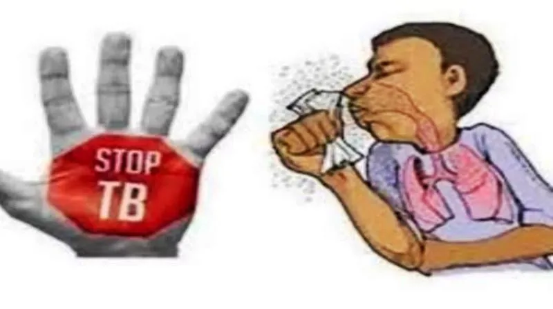 बरेली: टीबी रोगियों के लिए आशीष चौहान बने निक्षय मित्र, अब तक 15 मरीजों को ले चुके हैं गोद