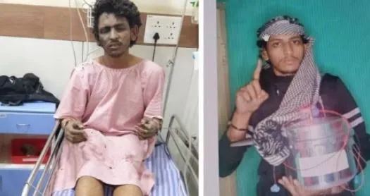 मेंगलुरु कुकर ब्लास्ट : NIA ने मोस्ट वांटेड मतीन ताहा पर रखा तीन लाख रुपए का इनाम 