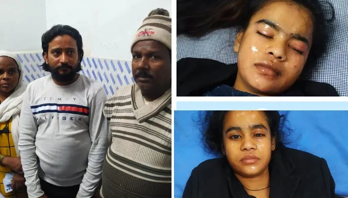 Kanpur: डांस के दौरान दो सगी बहनों के चेहरे पर पड़ा तेजाब, इलाके में मचा हड़कंप, पुलिस ने तीन को हिरासत में लिया