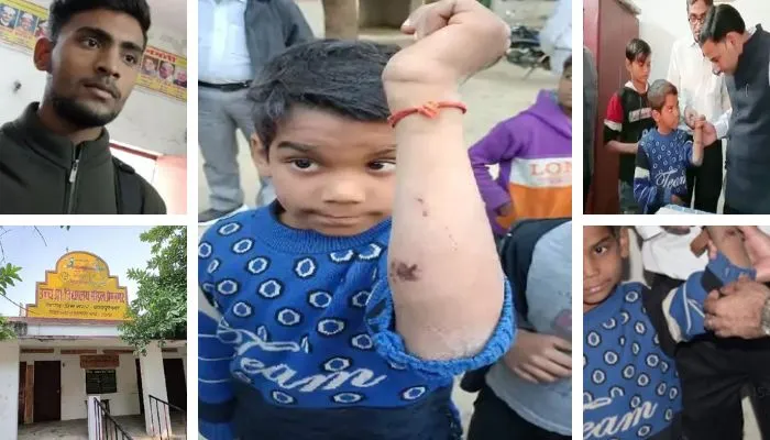 Kanpur में दो का पहाड़ा नहीं सुनाने पर छात्र के हाथ पर चलाई थी ड्रिल मशीन, अनुदेशक को किया गया निष्कासित