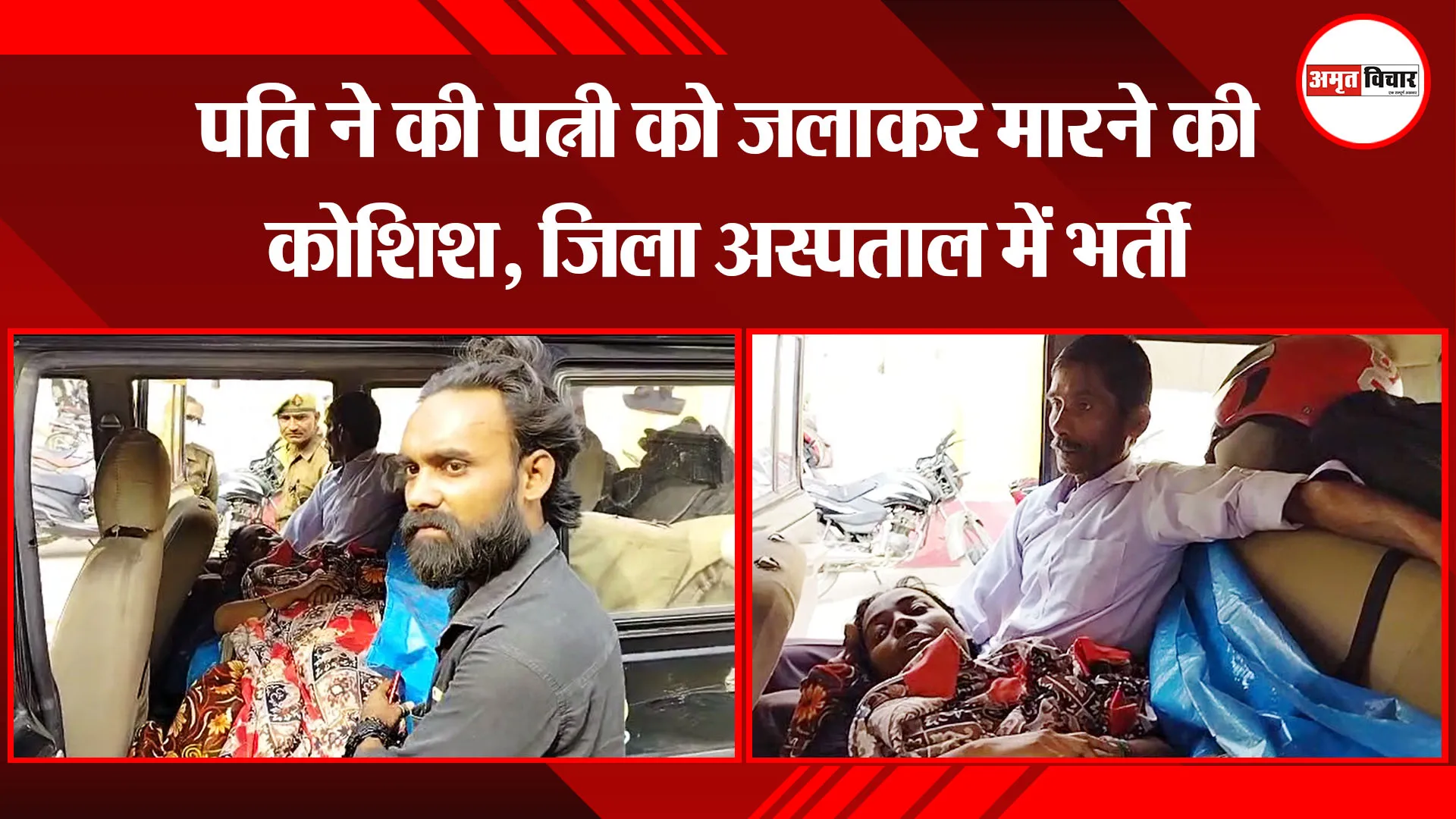 बरेली: पति ने की पत्नी को जलाकर मारने की कोशिश, जिला अस्पताल में भर्ती