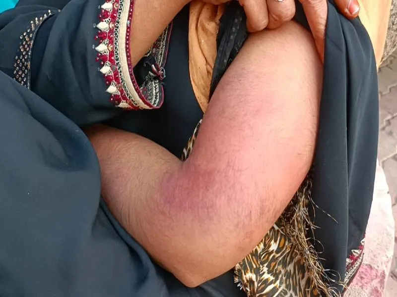 बहराइच: विवेचना के लिए पहुंची महिला पुलिस तो पति ने पत्नी को जमकर पीटा, जानें मामला
