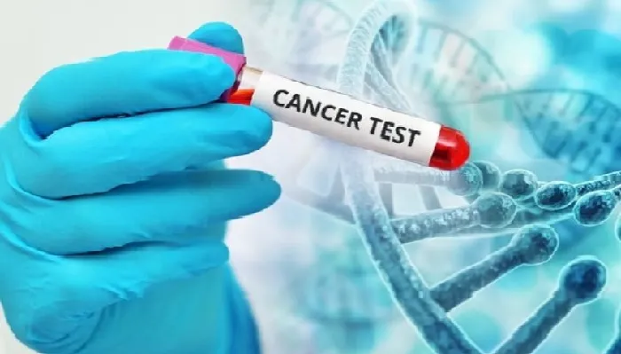 राष्ट्रीय कैंसर दिवस पर विशेष : शुरुआती लक्षणों की जांच करा कैंसर को दें मात