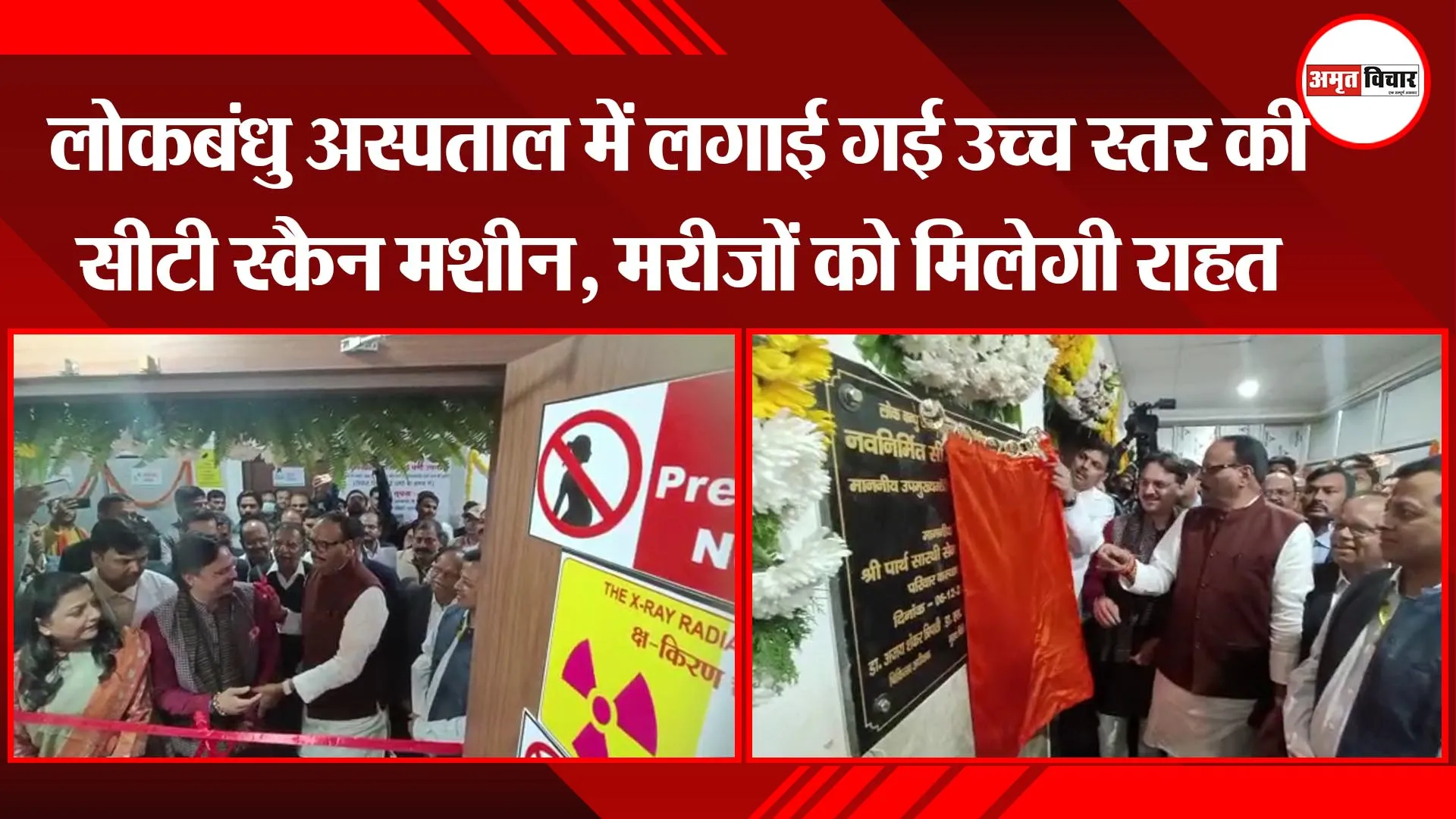 लखनऊ: लोकबंधु अस्पताल में लगाई गई उच्च स्तर की सीटी स्कैन मशीन, मरीजों को मिलेगी राहत