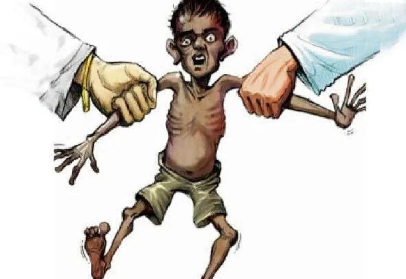 मुरादाबाद : मौसम बदलते ही बढ़ी अति गंभीर कुपोषित बच्चों की संख्या, आवश्कतानुसार भेजा जाएगा एनआरसी
