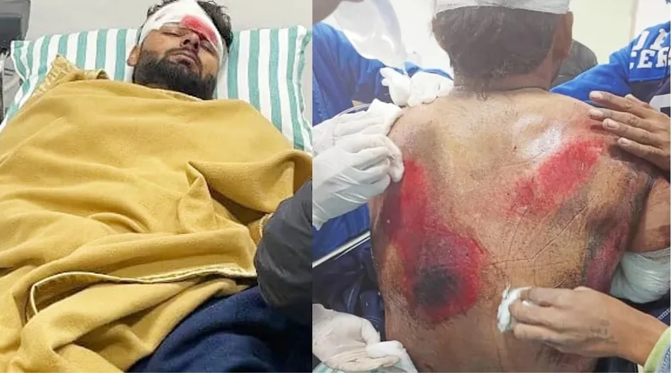 ऋषभ पंत चोटिल