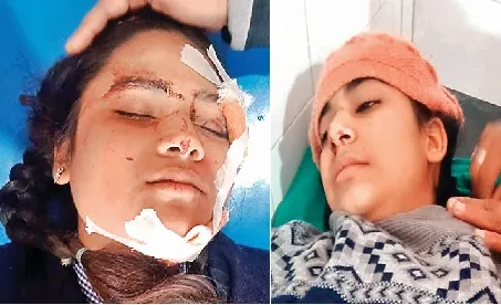 काशीपुर: कैंटर की टक्कर से तीन विद्यार्थी घायल, छात्र की हालत गंभीर