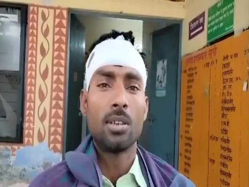 बहराइच में बकरी को बचाने के लिए तेंदुए से भिड़ा जांबाज युवक, घायल का अस्पताल में चल रहा इलाज 