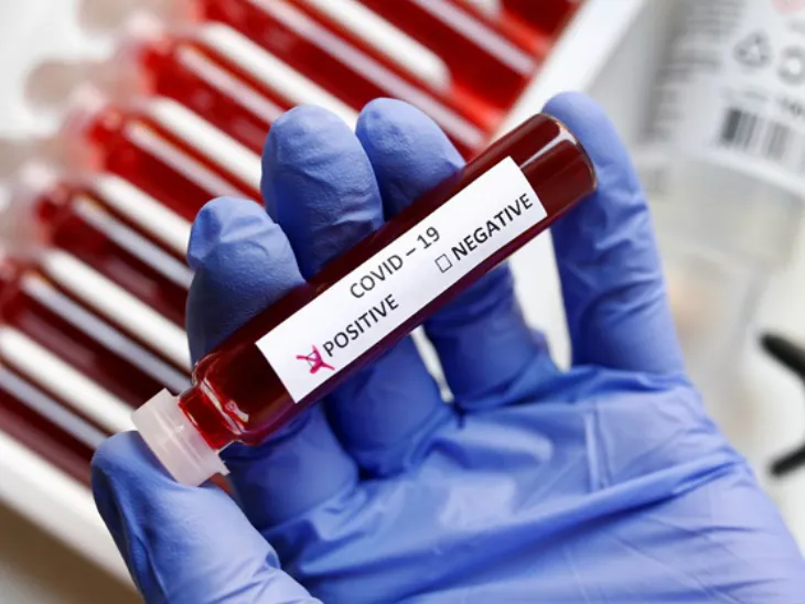 पीलीभीत में हुई जांच तो शाहजहांपुर में भी खुला कोरोना का खाता