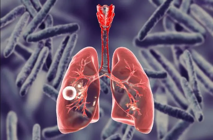 टीबी से मुक्ति पाने के भारत के लक्ष्य में मोाबाइल ऐप कर रहा स्वास्थ्यकर्मियों की मदद 