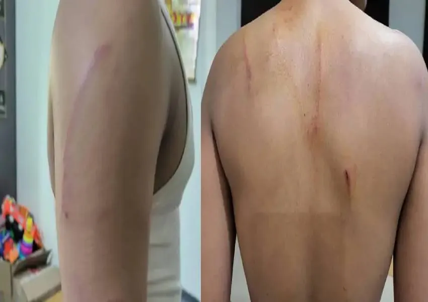 लखनऊ: छात्राओं से छेड़छाड़ को लेकर छात्रों के दो गुटों में हिंसक झड़प, 40 से अधिक छात्र घायल 