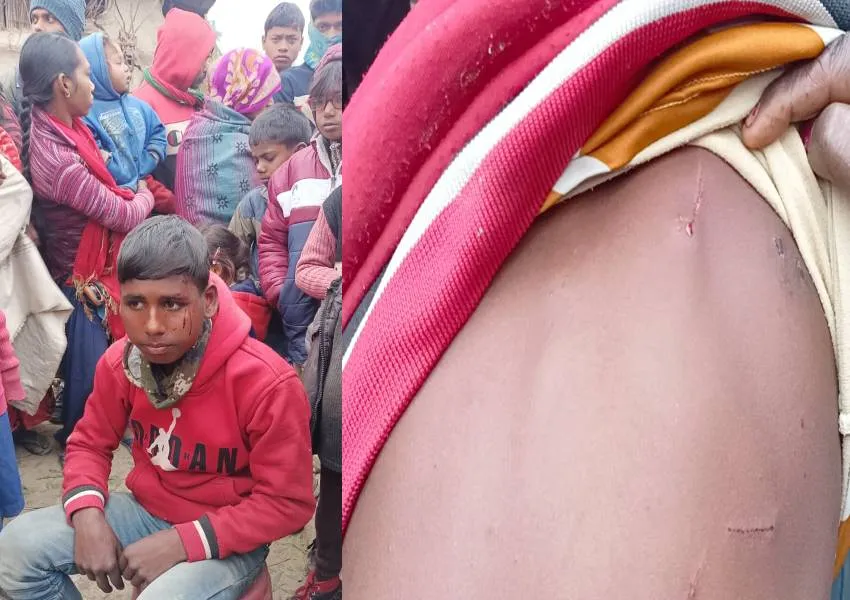 बहराइच: तेंदुए से भिड़ गया सूरज, 13 मिनट तक हुआ संघर्ष, बची जान ...घटना से ग्रामीणों में गुस्सा