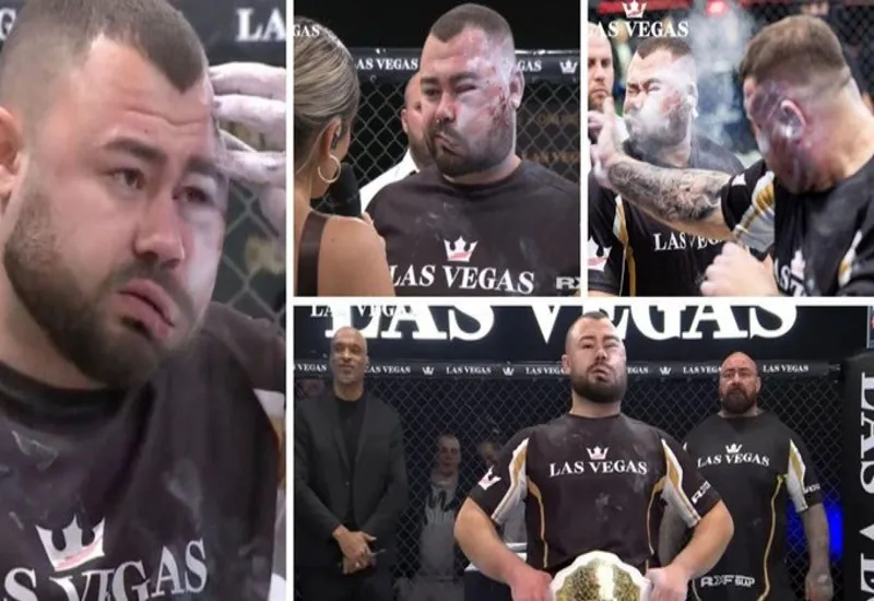 थप्पड़ चैंपियनशिप जीतने वाले शख्स का सूज गया चेहरा, लोग बोले- बैन करो 