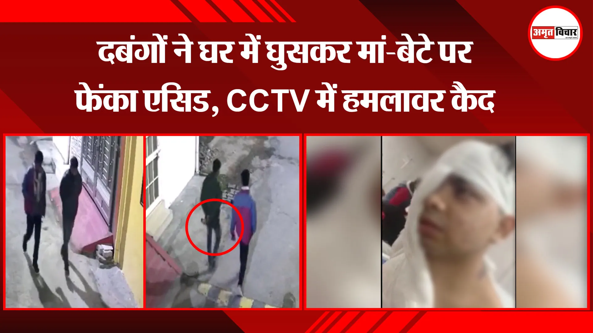  लखनऊ: दबंगों ने घर में घुसकर मां-बेटे पर फेंका एसिड, CCTV में हमलावर कैद
