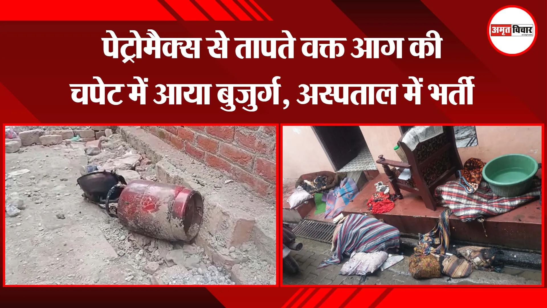 बरेली: पेट्रोमैक्स से तापते वक्त आग की चपेट में आया बुजुर्ग, अस्पताल में भर्ती