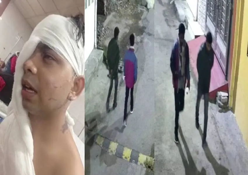 Acid Attack: लखनऊ में बेखौफ दबंगों ने घर में घुसकर मां-बेटे पर फेंका एसिड, इलाके में सनसनी