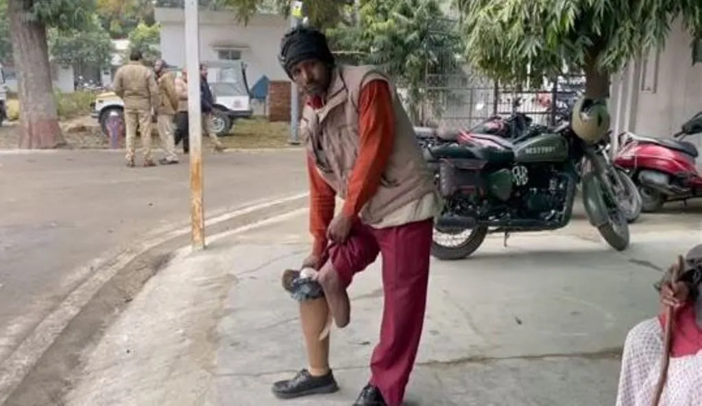 बरेली: फैक्ट्री में हुआ था हादसा, काटना पड़ा पैर, अब बकाया भुगतान के लिए एसएसपी से लगाई न्याय की गुहार 