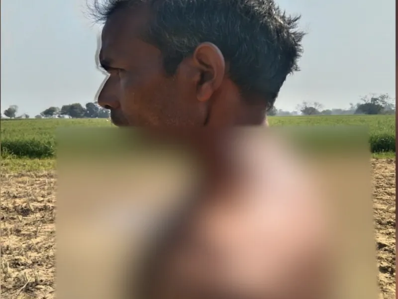 हरदोई: जंगली जानवर के हमले से किसान घायल, ग्रामीणों में दहशत का माहौल
