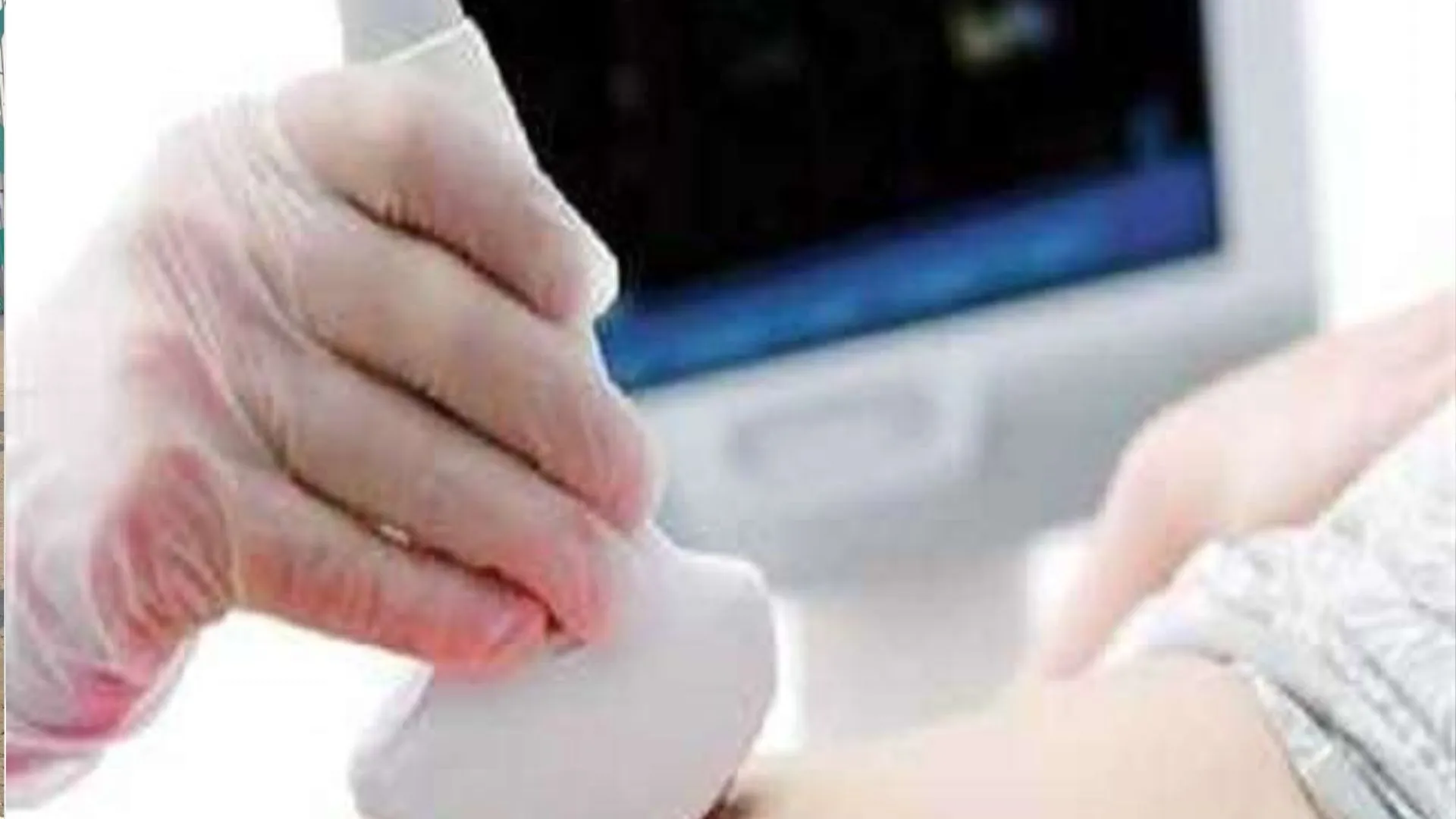 बरेली: 232 पंजीकृत, चल रहे 500 से अधिक अल्ट्रासाउंड सेंटर