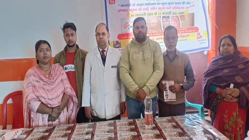 मुरादाबाद : भ्रांतियों को दूर कर समय पर इलाज से दूर होगा कुष्ठ रोग