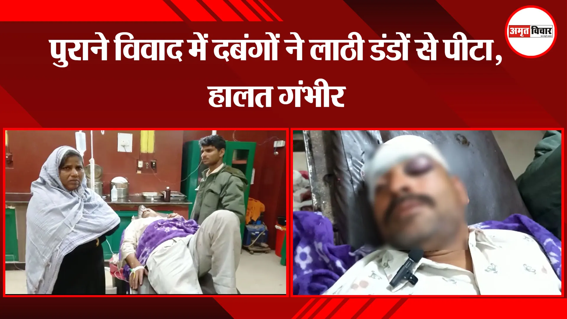 अयोध्या: पुराने विवाद में दबंगों ने लाठी डंडों से पीटा, हालत गंभीर