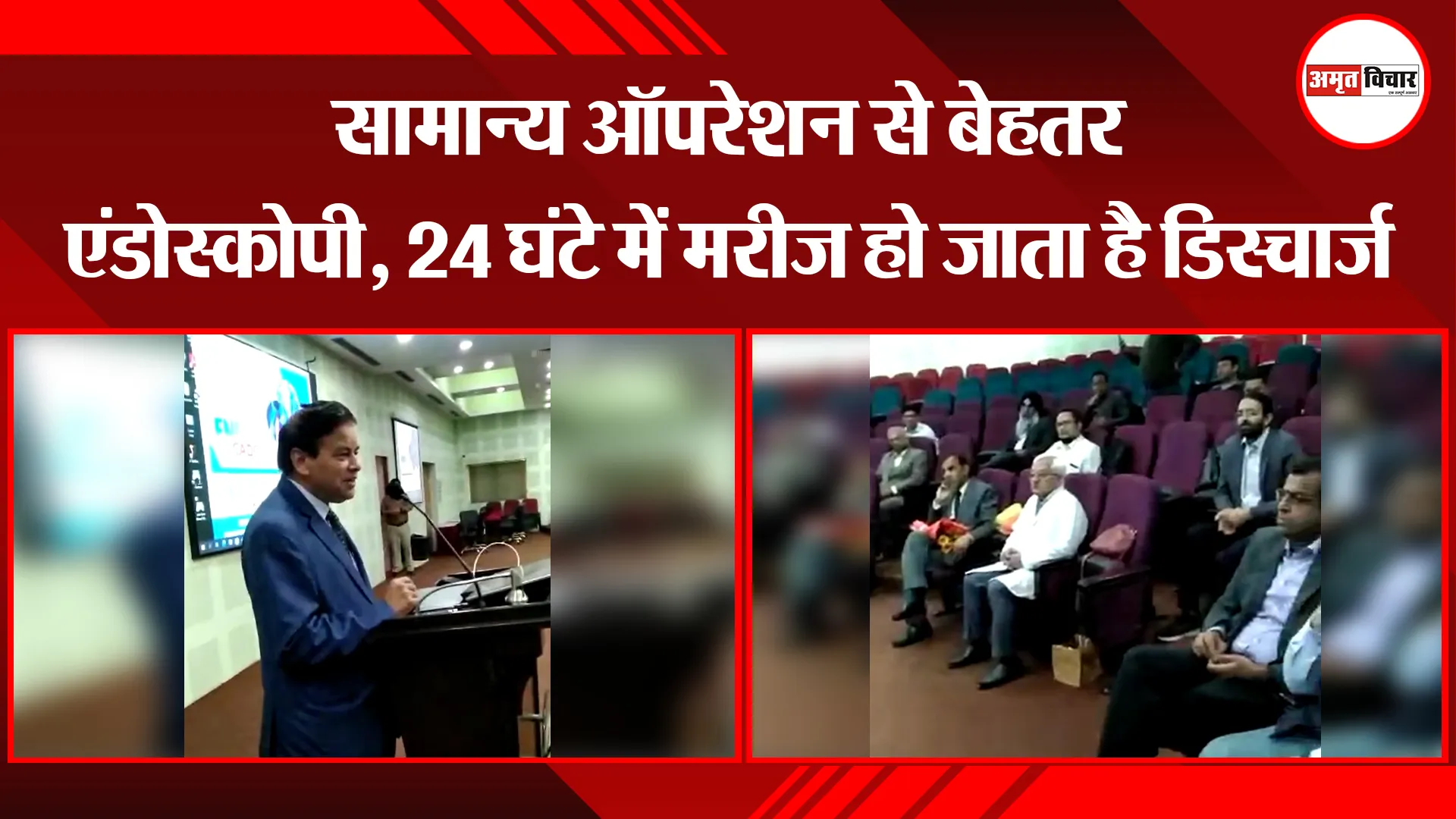 बरेली: सामान्य ऑपरेशन से बेहतर एंडोस्कोपी, 24 घंटे में मरीज हो जाता है डिस्चार्ज 
