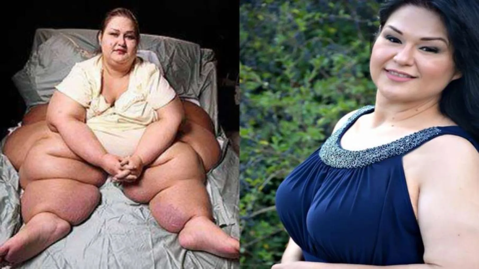 Amazing Transformation: कभी इस महिला का वजन था साढ़े 4 क्विंटल, घर तोड़कर निकालना पड़ा था बाहर