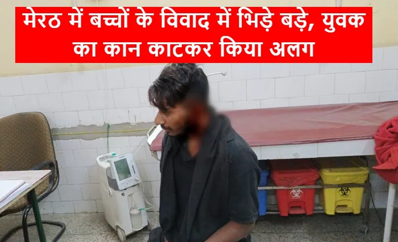 मेरठ: बच्चों के विवाद में भिड़े बड़े, युवक का कान काटकर किया अलग