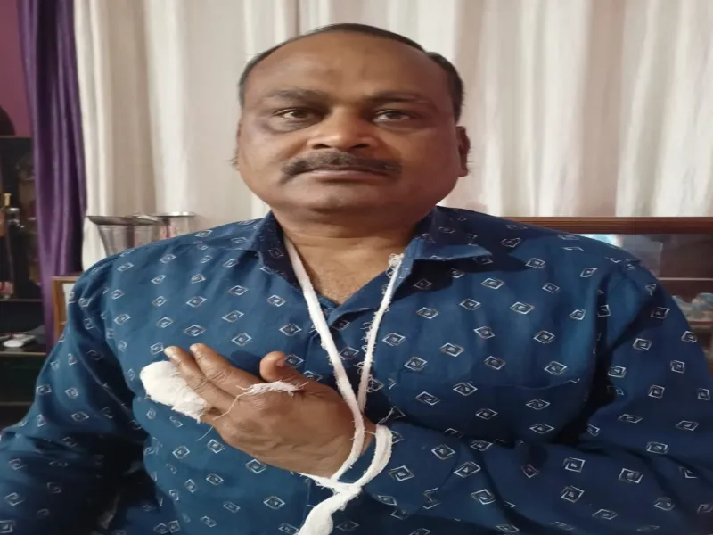 हरदोई: चाइनीज मांझा से कटकर दूर जा गिरी अधिवक्ता की उंगली, नहीं रुक रहा है प्रयोग 