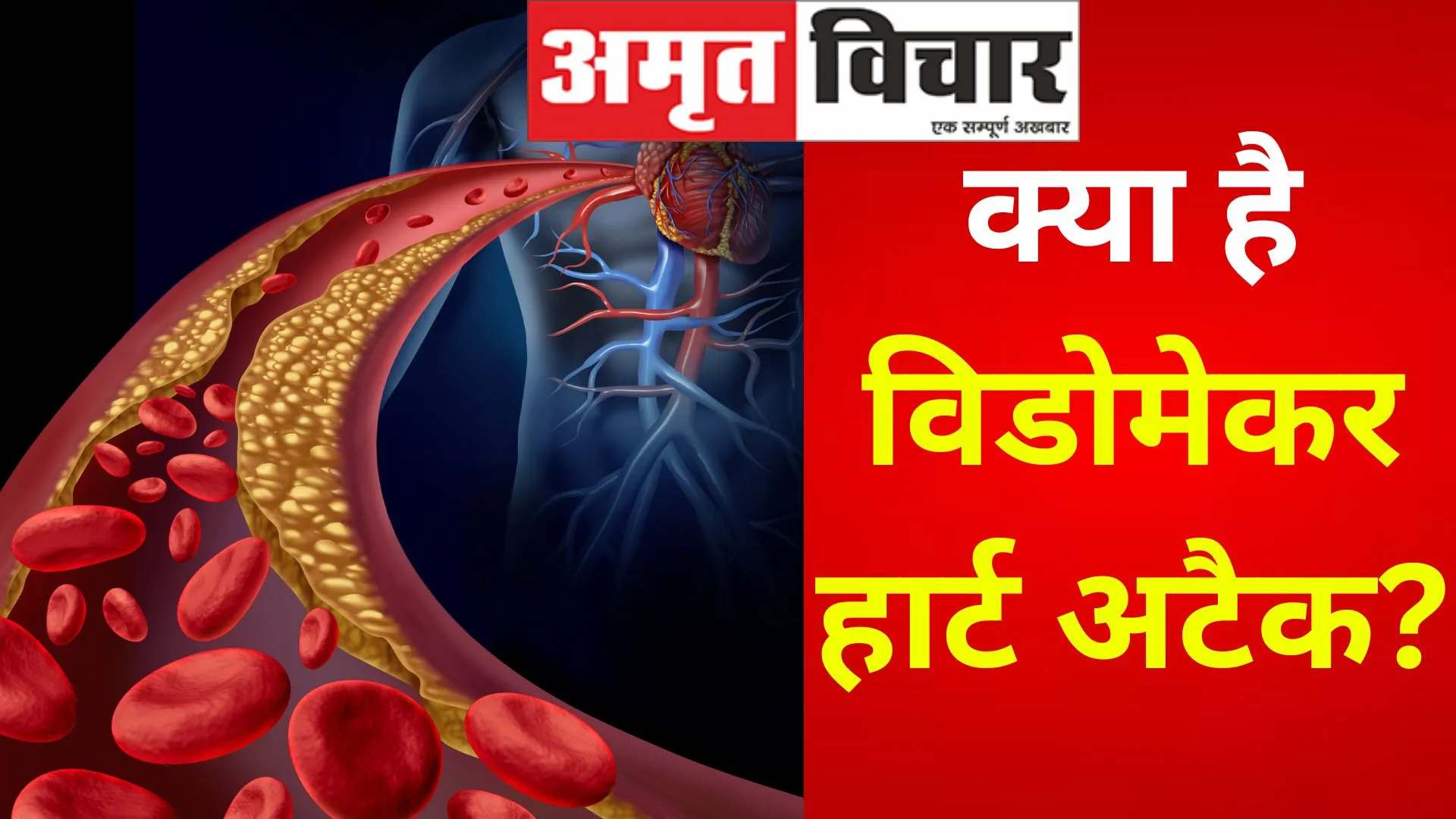Widowmaker Heart Attack : क्या है विडोमेकर हार्ट अटैक? जानिए इसके लक्षण और कैसे करें देखभाल
