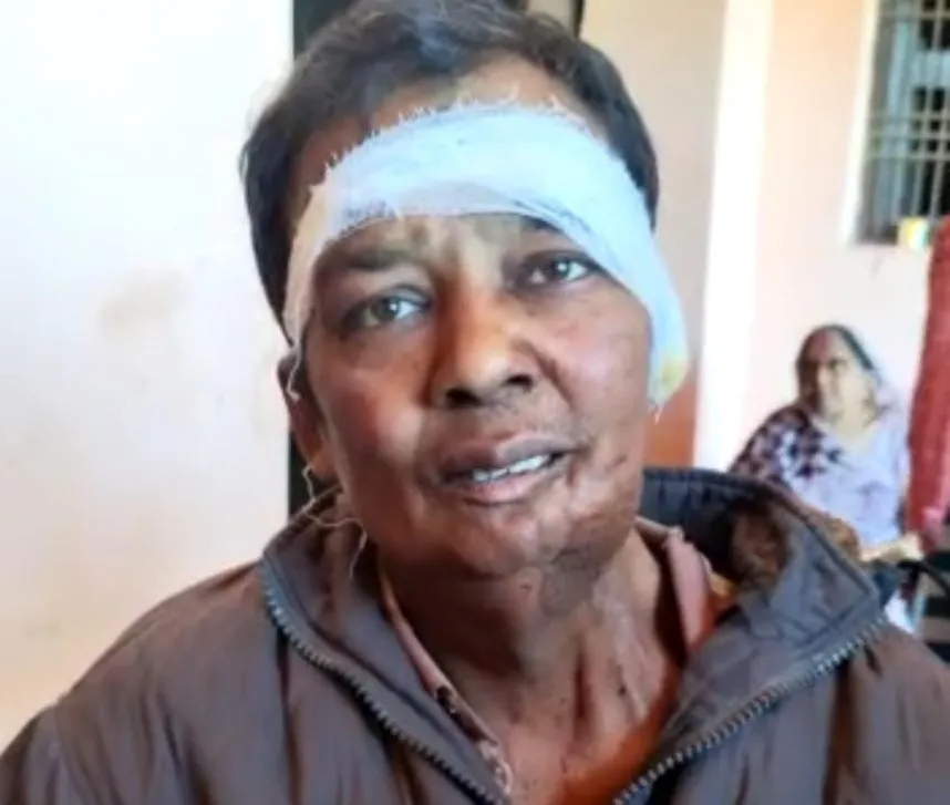 सुल्तानपुर: पूर्व प्रधान के पुत्र पर बदमाशों का हमला, घर में घुसकर चाकू से किये कई वार