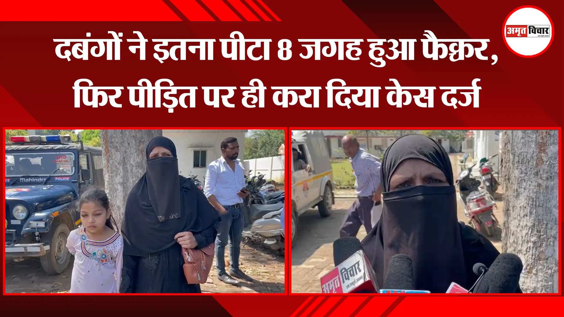 बरेली: दबंगों ने इतना पीटा 8 जगह हुआ फैक्चर, फिर पीड़ित पर ही करा दिया केस दर्ज