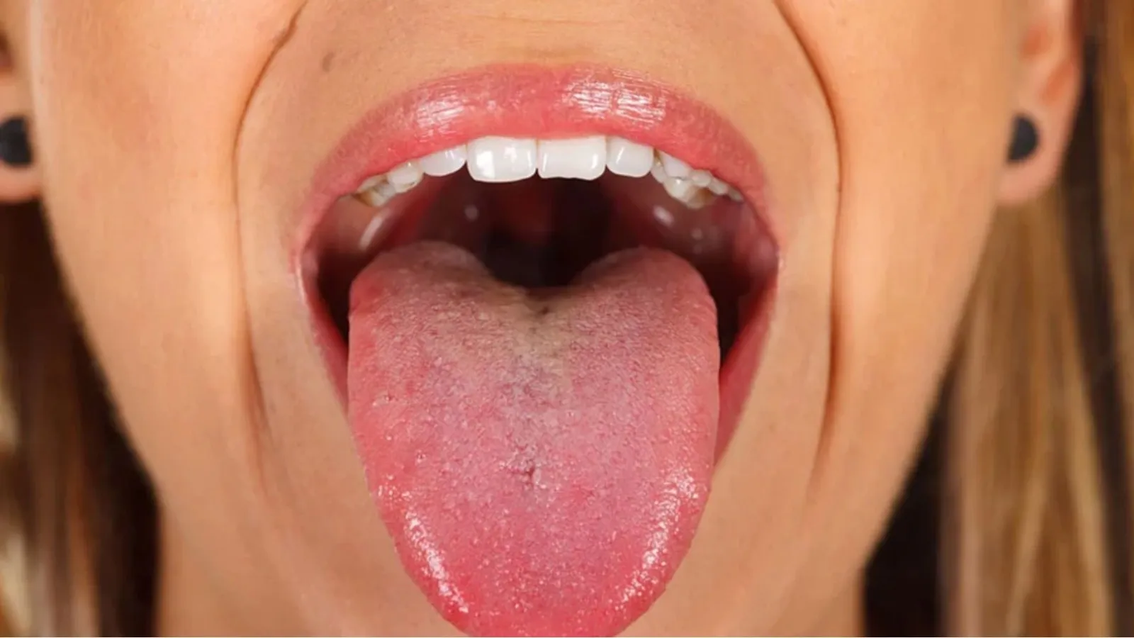 Vitamin B12 Deficiency Symptoms: जीभ का एक बड़ा हिस्सा है सफेद तो समझ लें आपके शरीर में हो रही इस विटामिन की कमी