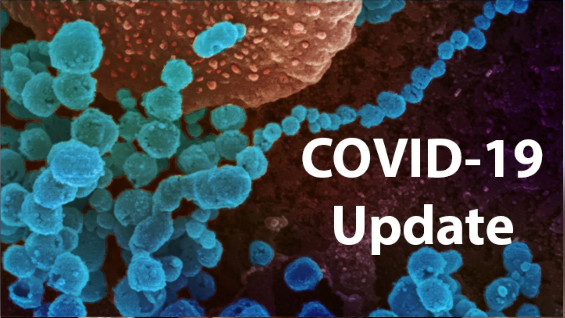 Covid-19: कोरोना से 24 घंटे में 27 लोगों की मौत, एक्टिव केस 60 हजार के पार