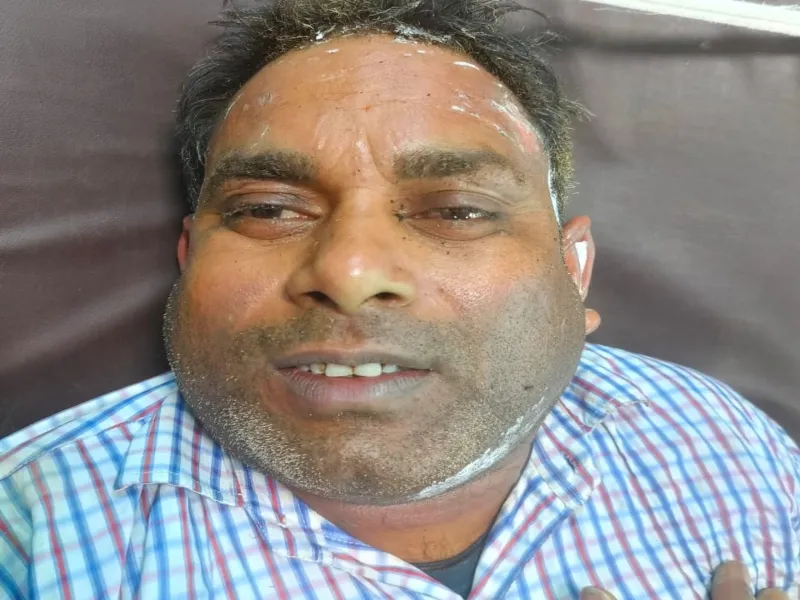 फर्रुखाबाद: देवी जागरण का प्रसाद बनाते समय सिलेंडर में लगी आग, नाती और नानी की मौत- एक दर्जन लोग घायल