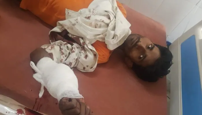 Banda News : मायके पक्ष ने पत्नी को नहीं भेजा ससुराल, गुस्से में आकर पति ने हाथ की काटी नस, फिर हुआ ये