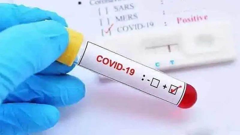 मुरादाबाद : महिला चिकित्सक व स्वास्थ्यकर्मी सहित 14 और कोरोना संक्रमित