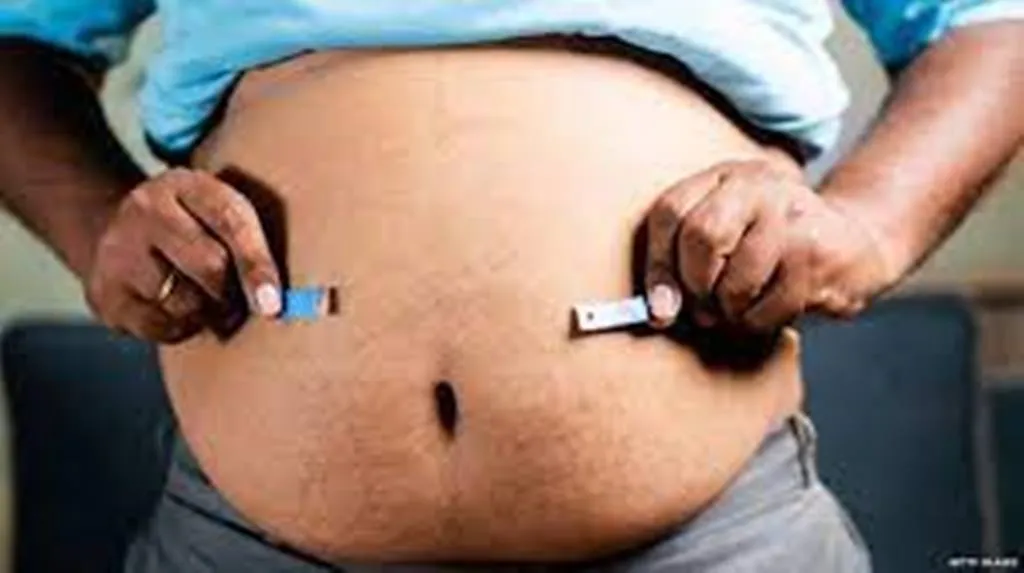 बहुत मोटे हो रहे भारतीय, 50 प्रतिशत की आई बढ़ोतरी : अपोलो की वार्षिक रिपोर्ट 