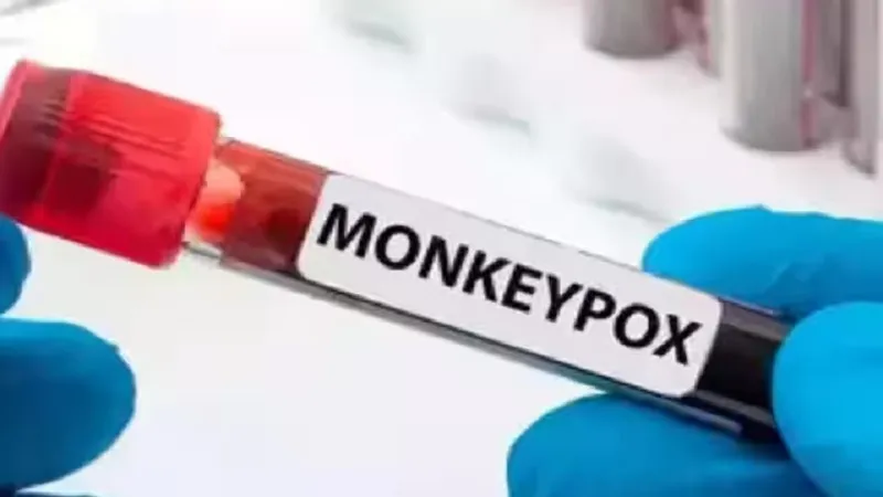 Pakistan : बलूचिस्तान में बढ़ा Monkeypox का खतरा, स्कूलों में हाई अलर्ट जारी 