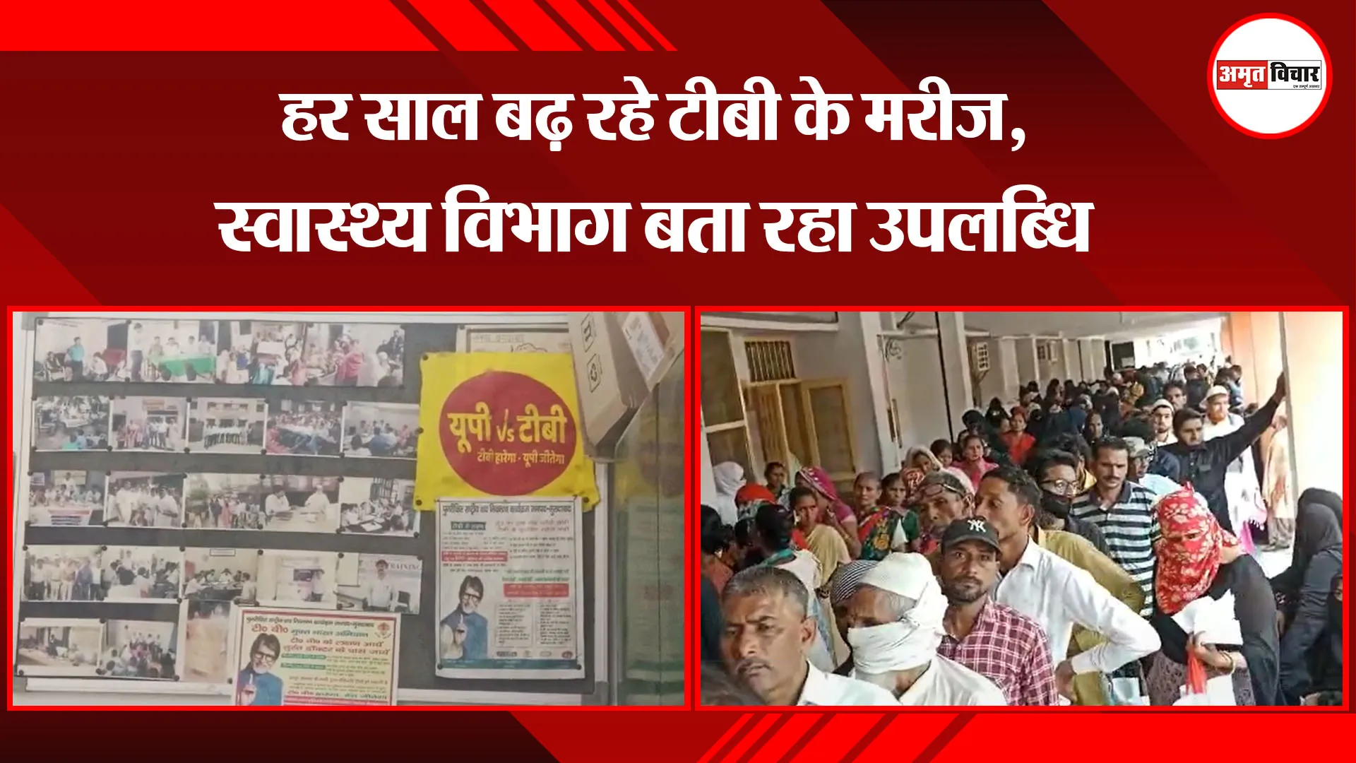  मुरादाबाद: हर साल बढ़ रहे टीबी के मरीज, स्वास्थ्य विभाग बता रहा उपलब्धि